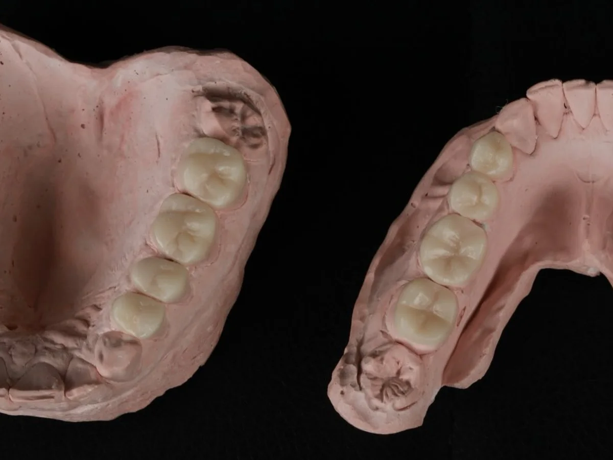 Detalhe do trabalho odontológico da Dra. Lara Eckert