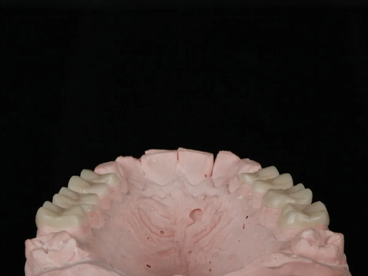 Detalhe do trabalho odontológico da Dra. Lara Eckert